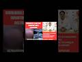 Submandibular gland swelling #ultrasound #radiology #viralvideo #doctor #foryou #fyp #youtubeshorts