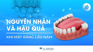 NGUYÊN NHÂN VÀ HẬU QUẢ KHI MẤT RĂNG LÂU NĂM