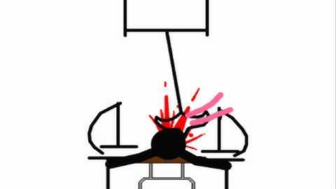 Saw Pendulum trap (stick Figure)