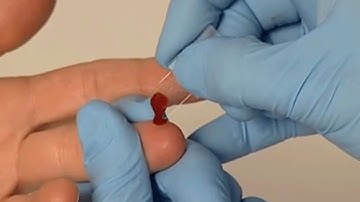 HemoCue Hb 201+ Capillary Sampling / HemoCue Hb 201+ Capilar de Muestreo