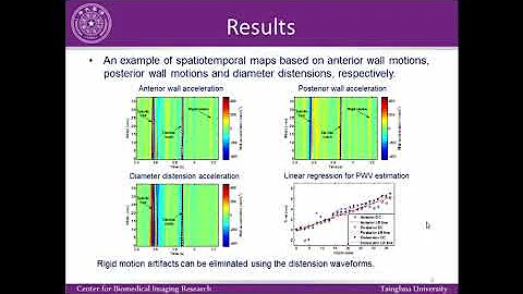 Pulse Wave Velocity (PWV) Measurement in Healthy and Diseased Carotid Arteries in Vivo