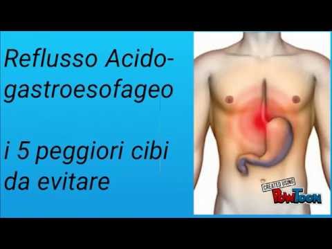Reflusso Gastroesofageo - i 5 peggiori cibi da evitare - YouTube