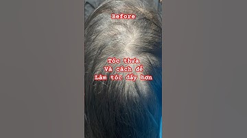 Tóc thưa ở nữ và cách hay để phục hồi chúng.. #reviewxămtóc