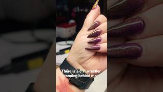 My Cuticles Are Trashed.