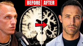 Surgeon: Bryan Johnson's $2 Million Blueprint is Shrinking Your Brain