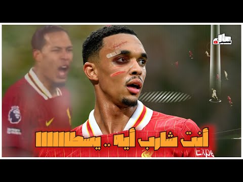 تحليل أخطاء أرنولد الكارثية امام اليونايتد 🤦‍♂️💔