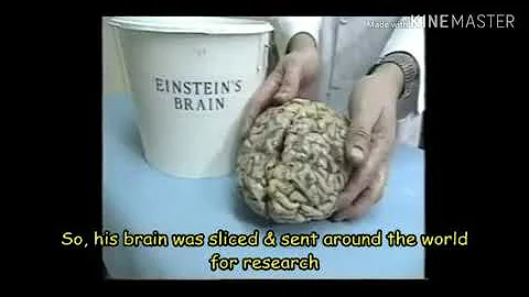 What made Albert Einstein so smart?