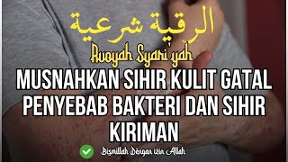 Ruqyah Magic For Itchy Skin Caused By Bacterial Fungus And Magic Sent