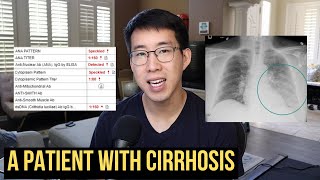 More Than Just A GI Bleed (How To Build A Problem List)