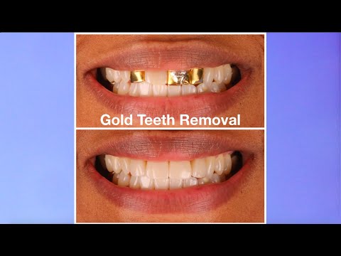 Video: Ce fac crematoriile cu dinții de aur?