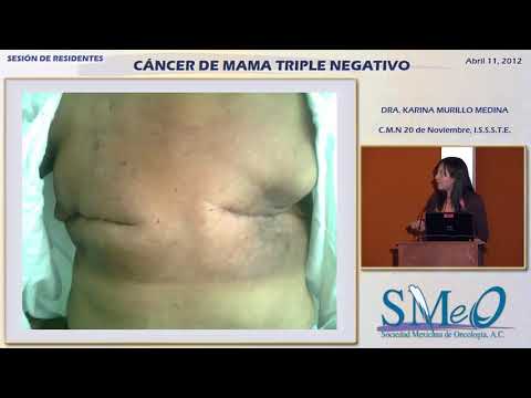 Quimioterapia en pastillas para cáncer de hígado