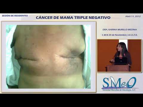 Vídeo: Los Primeros 5 Años: Tasa De Recurrencia Para El Cáncer De Mama Triple Negativo