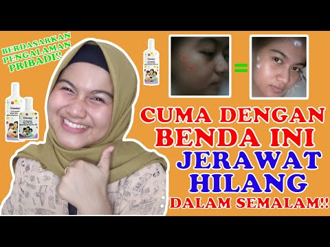 Video: Calamine Lotion Untuk Jerawat: Manfaat, Langkah Berjaga-jaga, Dan Cara Menggunakannya