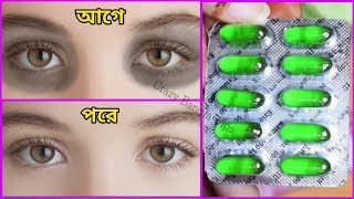ভিটামিন ই ক্যাপসুল দিয়ে চোখের নিচের কালো দাগ,কালো ছোপ দূর করার উপায়। screenshot 3