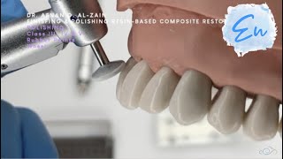 Finishing & polishing tools & application (2): Class III, IV, V composite restorations  En