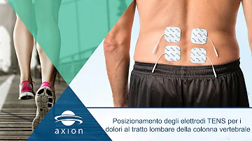 Dove posizionare gli elettrodi per elettrostimolazione?