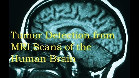 Brain Tumor Detection from MRI Scans