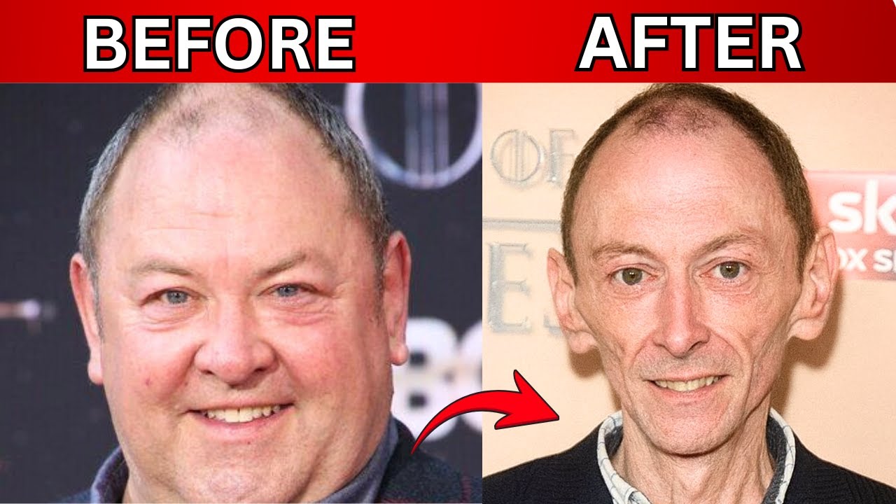 The REAL Reason Celebrities Look SO Different Now YouTube