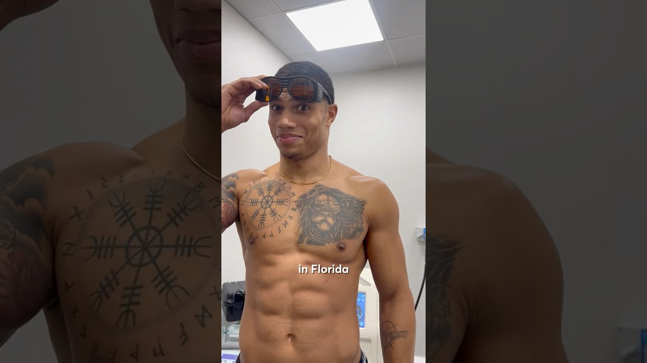 Why Justin removed his lion tattoo? A Fresh Start with Laser Tattoo Removal