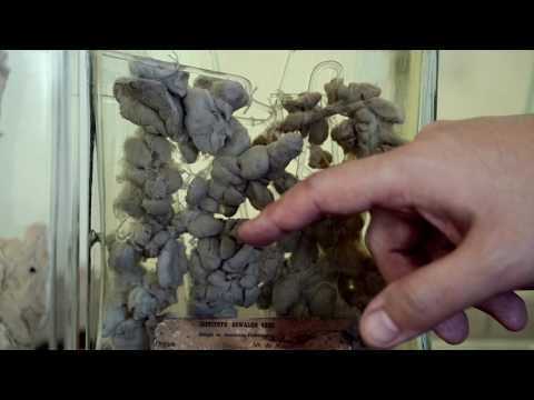 Miniatura do vídeo: Oncologia