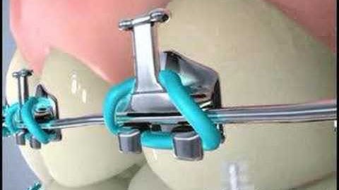 Easy Brush Cleaners by DenTek