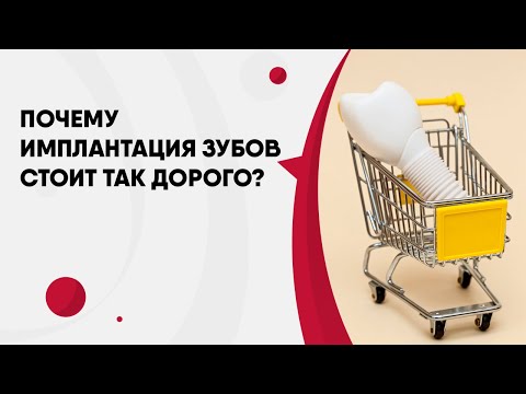 Почему имплантация зубов стоит так дорого? | Цена на имплантацию