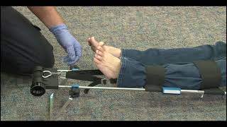 Hare Traction Splint Tutorial for EMT Students | EMT Skills Demo