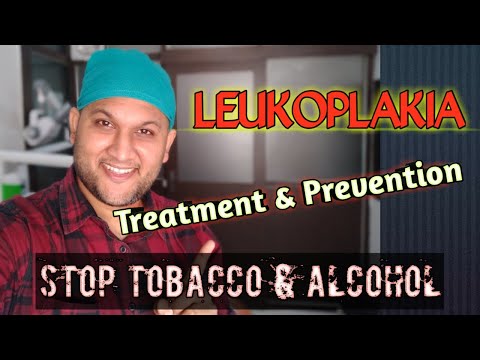 Leukoplakia:Treatment & Prevention | मुंह में सफेद दाग के लक्षण, कारण, इलाज | Oral Hairy Leukoplakia