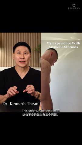 Dr. Thean Reacts: Does Anabolic Steroids Cause Acne? | Ensoul Medical Clinic