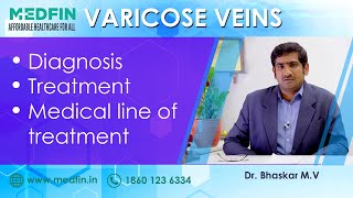 Diagnosis & Treatment for Varicose Veins