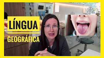 O que provoca a língua geográfica?