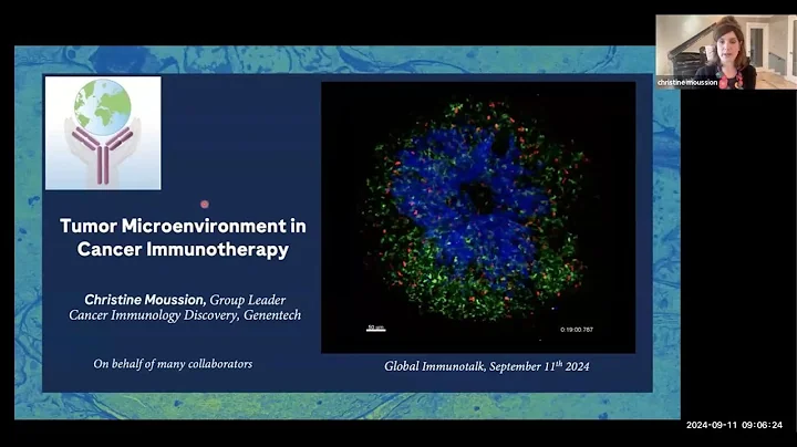 "Tumor microenvironment in cancer immunotherapy" by Dr. Christine Moussion