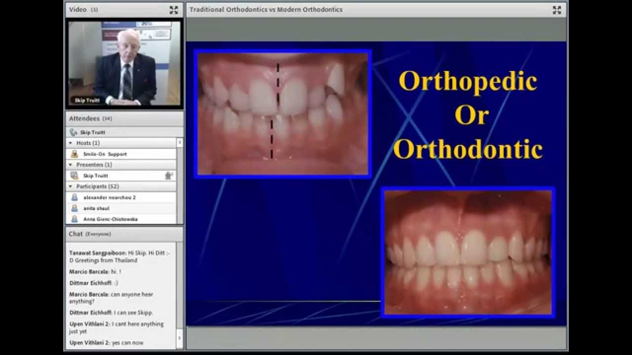 inar Traditional Orthodontics Vs Modern Orthodontics YouTube