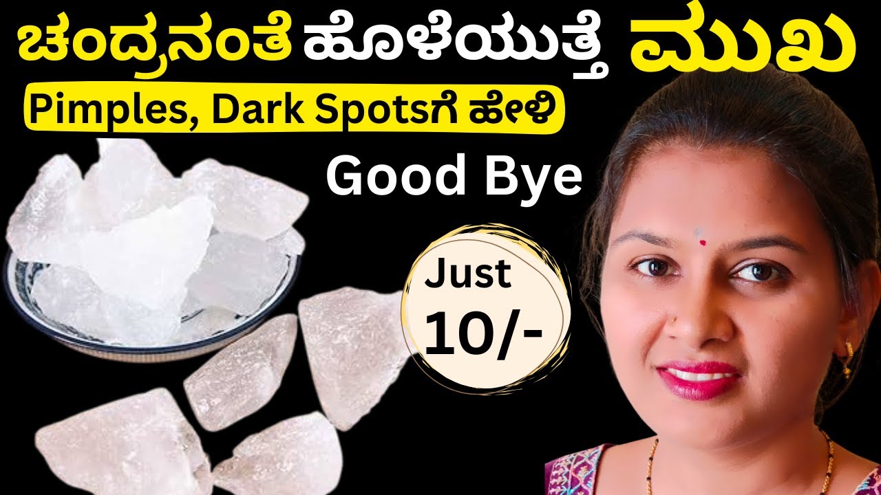 10/- ನಲ್ಲಿ ಮುಖ ಎಷ್ಟು Clear ಆಯಿತು ನೋಡಿ 😍 No Pimple, No Pigmentation | Alum Benefits in Kannada