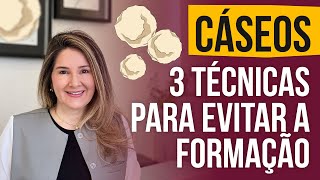 Cáseos Amigdalianos: 3 técnicas p/ evitar bolinhas mal cheirosas na garganta - Dra Karyne Magalhães
