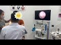 कान से निकली भारी मैल 😱 संतोषजनक Earwax Removal प्रक्रिया! #कानसफाई #EarwaxRemoval #ENT
