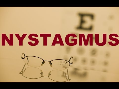 Nystagmus (Bengali)