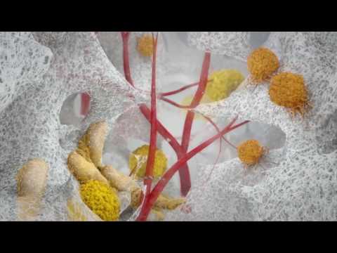 PolyNovo NovoSorb BTM Animation