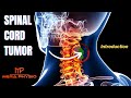 Spinal Cord Tumor | Introduction | In Hindi | Mera Physio