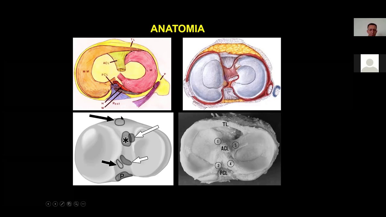 Ι. Τσιφουντούδης - Μαγνητική Τομογραφία Κακώσεων Γόνατος