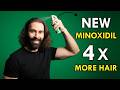 New Minoxidil: 4X More Effective (Thanks to Nanotechnology)