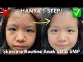 Skincare routine untuk menghilangkan jerawat anak sd  smp  christina immanuel