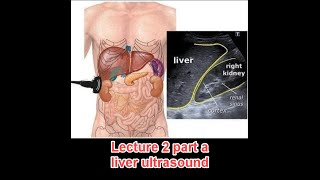 Abdominal ultrasound course : lecture 2 part a ( liver)  د عمرو صلاح
