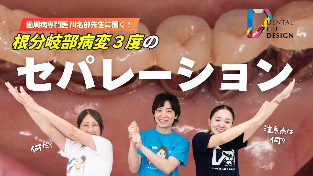 根分岐部病変Ⅲ度の対応のセパレーションってどんな処置？？注意点は