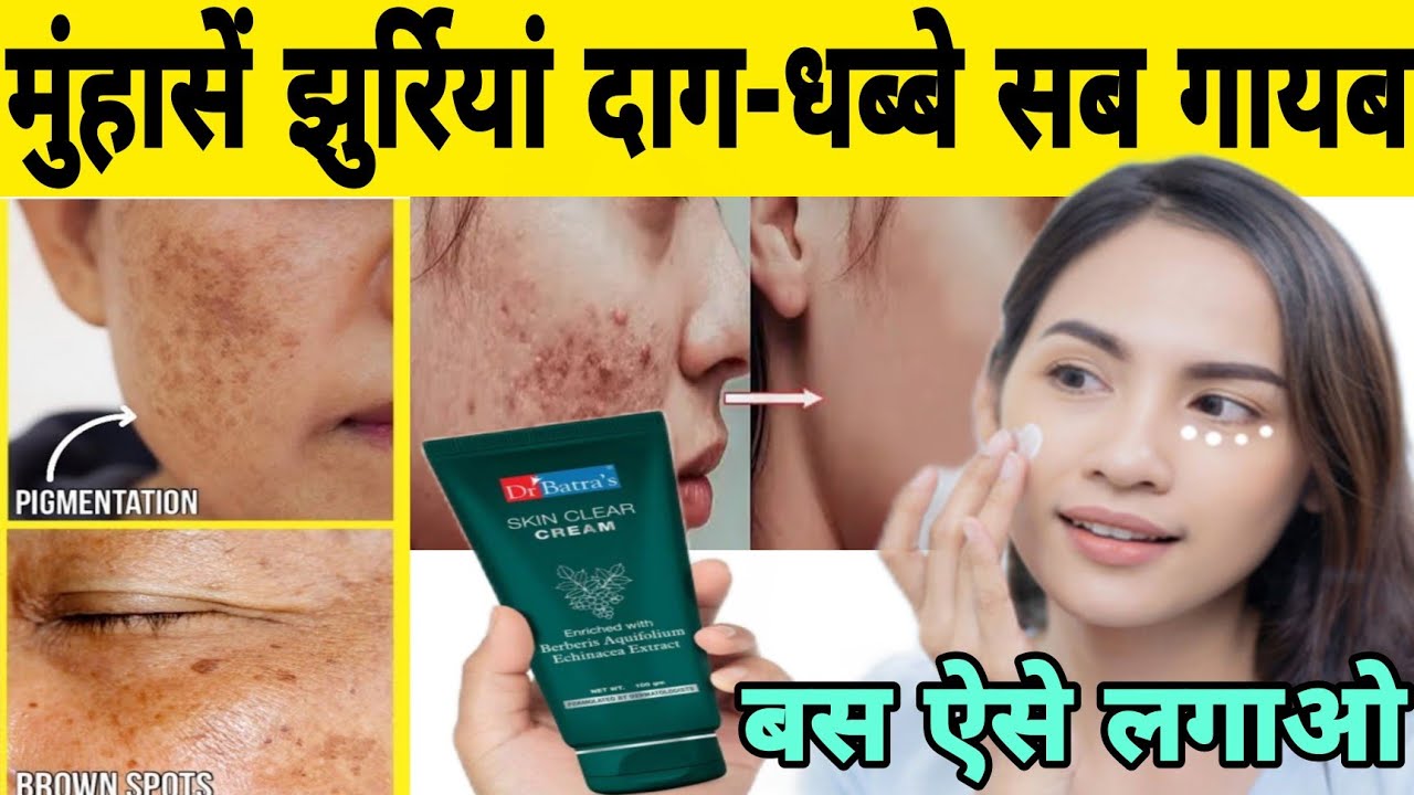 डॉक्टर द्वारा दि जाने वाली गोरेपन की क्रीम | Dr batra skin clear cream review in hindi