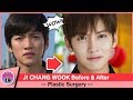  ji chang wook before and after plastic surgery netizen buzz
