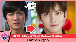 💬 Ji Chang Wook Before and After Plastic Surgery [NETIZEN BUZZ]