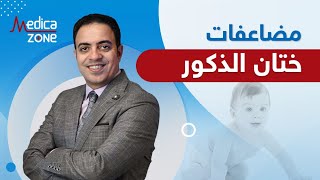 ما هي مضاعفات ختان الذكور؟ | دكتور محمد فتحي | Medicazone