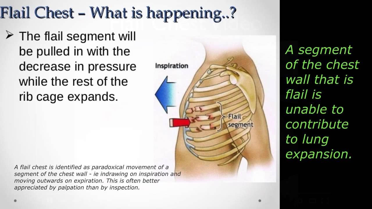 Blunt Chest Trauma - EMS Lecture 10/15 - YouTube