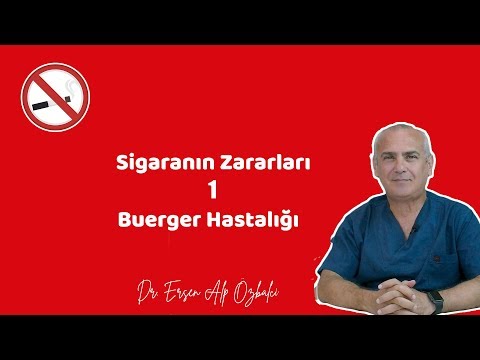 SİGARANIN ZARARLARI 1 (Buerger / Burger Hastalığı) -  Dr. Ersen Alp Özbalcı